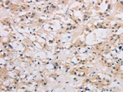 DDIT4L Antibody