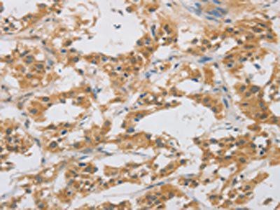 DDIT4L Antibody