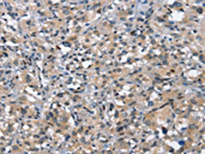 DDR2 Antibody