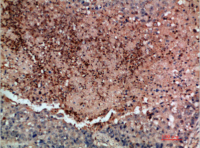 DDR2 Antibody