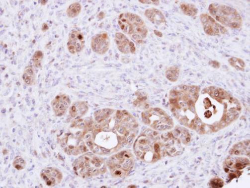 DDT antibody [N1C3]