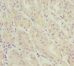 DDX11 Antibody