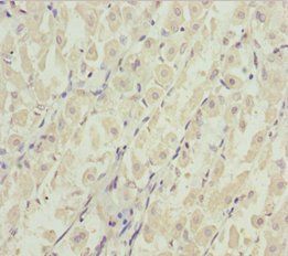 DDX11 Antibody