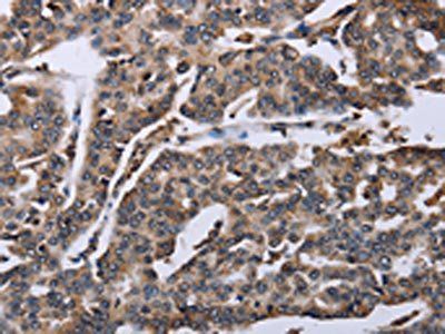 DDX11 Antibody
