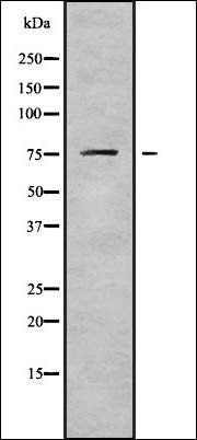 DDX18 antibody