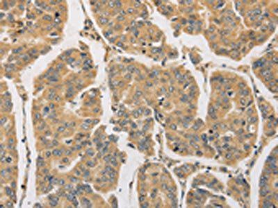 DDX19B Antibody