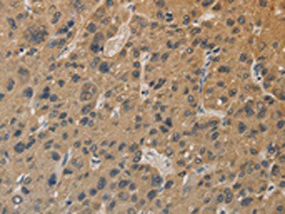 DDX19B Antibody