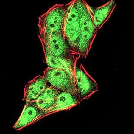 DDX20 Antibody