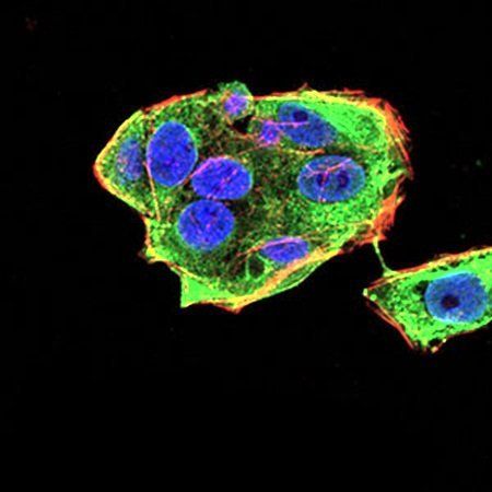 DDX20 Antibody