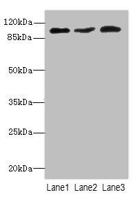 DDX20 antibody