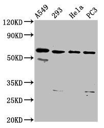 DDX28 Antibody