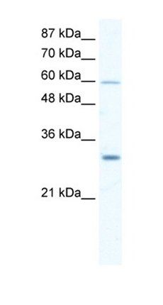 DDX31 antibody
