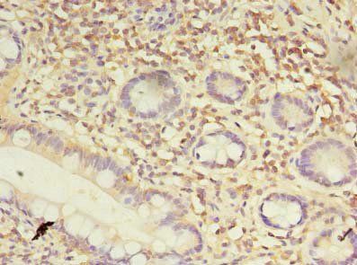 DDX31 Antibody