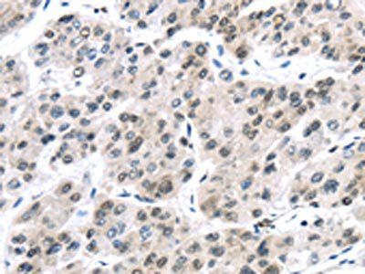 DDX39B Antibody
