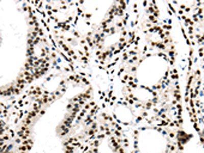 DDX39B Antibody