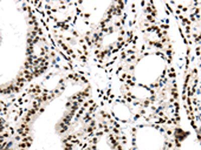 DDX39B antibody