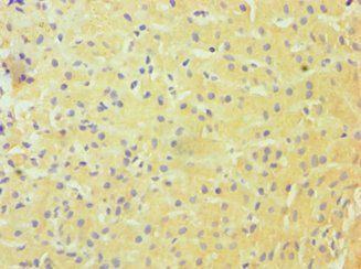 DDX3X Antibody