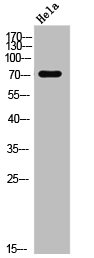 DDX3X/DDX3Y Antibody