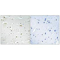 DDX3Y Antibody