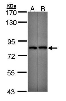 DDX3Y antibody