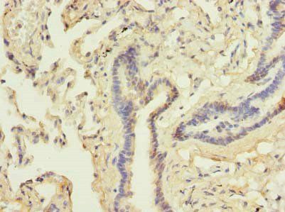DDX42 Antibody