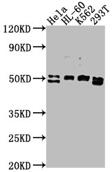 DDX47 antibody
