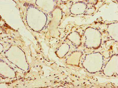 DDX50 Antibody