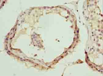 DDX55 Antibody