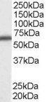 Goat anti-DDX5 / p68 RNA helicase Antibody