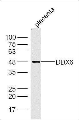 DDX6 antibody