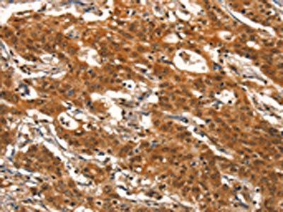 DEAF1 Antibody