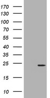 Decorin (DCN) antibody