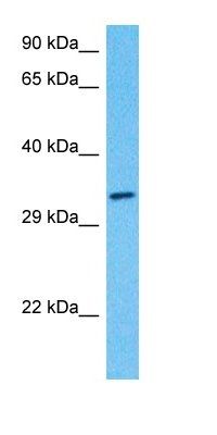 DECR antibody