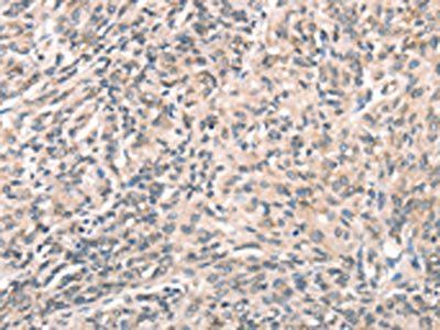 DECR1 antibody