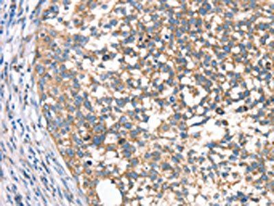 DECR1 Antibody