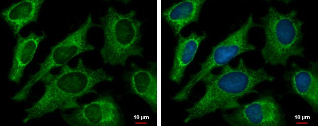 DECR1 antibody [N1C3]