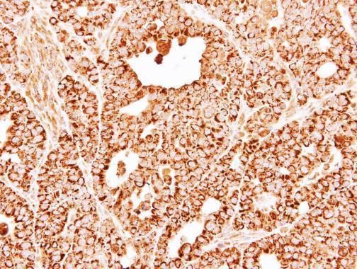 DECR1 Rabbit Polyclonal Antibody