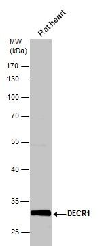 DECR1 Rabbit Polyclonal Antibody