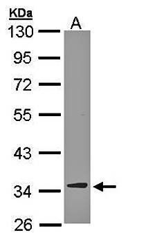 DECR1 antibody