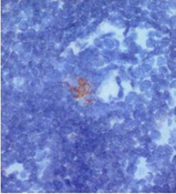Dectin-2 Rabbit Polyclonal Antibody