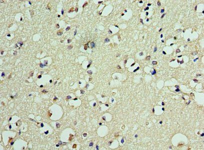 DEDD2 Antibody