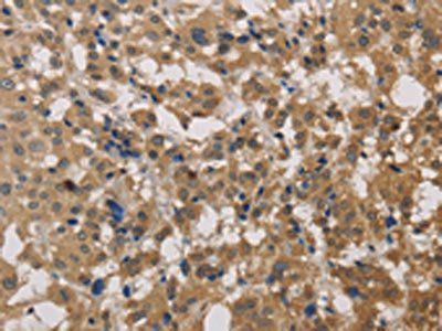 DEGS1 Antibody