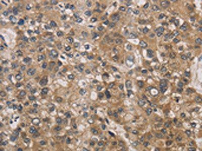 DEGS1 Antibody
