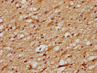 DLL3 Antibody
