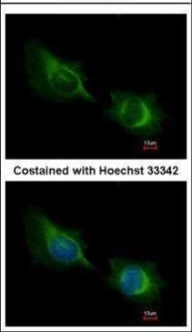 Deltex1 antibody