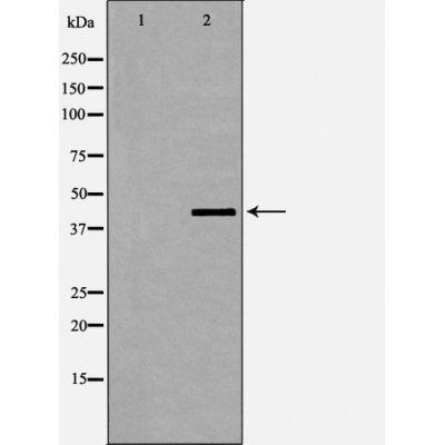 Dematin (Phospho-Ser403) antibody