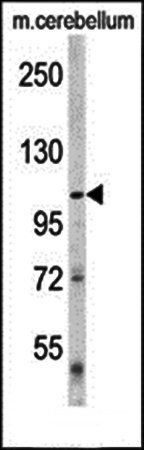 Denatured ATG1 antibody