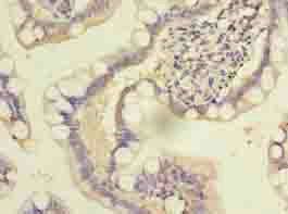 DENND2D Antibody