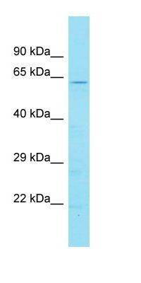 DENND6B antibody