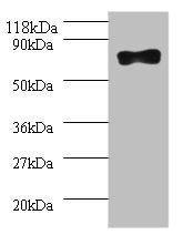 Deoxynucleoside triphosphate triphosphohydrolase SAMHD1 antibody